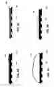 Fig. 06 - Multi-electrode epicardial pacing