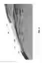 Fig. 07 - Multi-electrode epicardial pacing