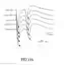 Fig. 28 - Method for reducing overactive bladder syndrome and computer-readable medium thereof