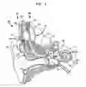 Fig. 02 - Stimulation parameter optimization