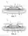 Fig. 05 - Configuration of hearing device components