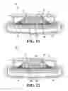 Fig. 07 - Configuration of hearing device components