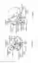 Fig. 02 - Extracranial implantable devices, systems and methods for the treatment of neuropsychiatric disorders