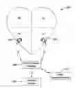 Fig. 01 - Systems and methods for infarct detection