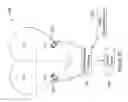 Fig. 16 - CARDIAC PACING WITH GOVERNOR