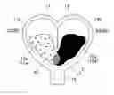 Fig. 01 - Accessory preparation toy