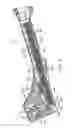 Fig. 09 - Hammer tacker