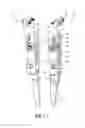 Fig. 02 - Robotic gripper mechanism