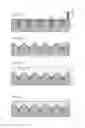 Fig. 15 - METHOD OF MANUFACTURING TRANSDERMAL ABSORPTION SHEET AND TRANSDERMAL ABSORPTION SHEET