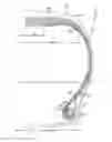 Fig. 01 - Reduced weight aircraft tire