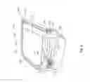 Fig. 07 - Intuitive vehicle control
