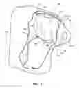 Fig. 04 - Airbag cushion stabilizers