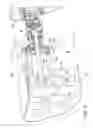 Fig. 07 - Crawler-track unit, forest machine and forest machine assembly