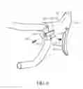 Fig. 06 - Dual control lever and bicycle control assembly