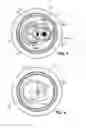 Fig. 02 - CONSTRUCTIVE ARRANGEMENT FOR THE OPENING OF A BEVERAGE CAN