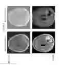 Fig. 06 - METHODS OF USING ANTI-ANG2 ANTIBODIES