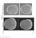 Fig. 07 - METHODS OF USING ANTI-ANG2 ANTIBODIES