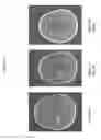 Fig. 08 - METHODS OF USING ANTI-ANG2 ANTIBODIES