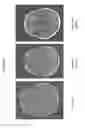 Fig. 09 - METHODS OF USING ANTI-ANG2 ANTIBODIES