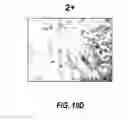 Fig. 18 - Anti-Ly6E antibodies and methods of use