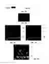 Fig. 06 - METHOD OF DETECTING OCULAR DISEASES AND PATHOLOGIC CONDITIONS AND TREATMENT OF SAME