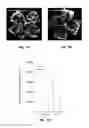 Fig. 08 - METHOD OF DETECTING OCULAR DISEASES AND PATHOLOGIC CONDITIONS AND TREATMENT OF SAME