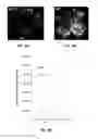 Fig. 09 - METHOD OF DETECTING OCULAR DISEASES AND PATHOLOGIC CONDITIONS AND TREATMENT OF SAME