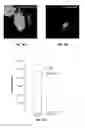 Fig. 10 - METHOD OF DETECTING OCULAR DISEASES AND PATHOLOGIC CONDITIONS AND TREATMENT OF SAME