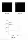 Fig. 11 - METHOD OF DETECTING OCULAR DISEASES AND PATHOLOGIC CONDITIONS AND TREATMENT OF SAME