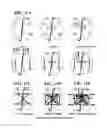 Fig. 13 - Covalently linked polypeptide toxin-antibody conjugates