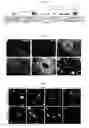 Fig. 02 - Composition for inducing direct transdifferentiation into oligodendrocyte progenitor cells from somatic cells and use thereof