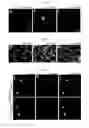 Fig. 04 - Composition for inducing direct transdifferentiation into oligodendrocyte progenitor cells from somatic cells and use thereof