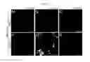 Fig. 05 - Composition for inducing direct transdifferentiation into oligodendrocyte progenitor cells from somatic cells and use thereof