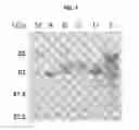 Fig. 08 - Method for the detection of polypeptide specific immune cells