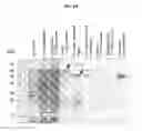 Fig. 20 - Method for the detection of polypeptide specific immune cells