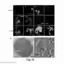 Fig. 11 - Megakaryocytic particles and microparticles for cell therapy and fate modification of stem and progenitor cells