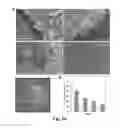 Fig. 19 - Megakaryocytic particles and microparticles for cell therapy and fate modification of stem and progenitor cells