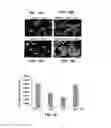 Fig. 13 - FORMATION OF MULTICELLULAR TUMOROIDS AND USES THEREOF