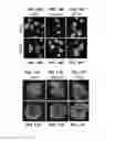 Fig. 14 - FORMATION OF MULTICELLULAR TUMOROIDS AND USES THEREOF