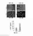 Fig. 15 - FORMATION OF MULTICELLULAR TUMOROIDS AND USES THEREOF