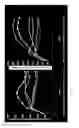 Fig. 04 - GENETICALLY ENGINEERED SENSORS FOR IN VIVO DETECTION OF BLEEDING