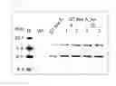Fig. 07 - Method utilizing piggybac transposon and transposase to introduce mutation into target DNA in a plant cell