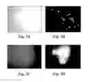 Fig. 06 - NOVEL METHODOLOGY FOR IDENTIFYING ANTI-PERSISTER ACTIVITY AND ANTIMICROBIAL SUSCEPTIBILITY FOR BORRELIA BURGDORFERI AND OTHER BACTERIA