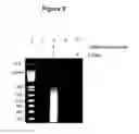 Fig. 05 - Immobilized transposase complexes for DNA fragmentation and tagging