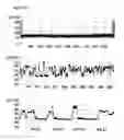 Fig. 33 - Method of improving the movement of a target polynucleotide with respect to a transmembrane pore