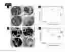 Fig. 06 - Methods for Prediction of Clinical Response to Radiation Therapy in Cancer Patients