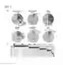 Fig. 04 - Polypeptides and Antibodies for Assessing Predisposition for Myelodysplastic Syndromes or Myelogenous Tumor, and Method for Screening Therapeutic Drugs Therefor