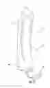 Fig. 15 - Portable barrier and associated method of use