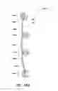 Fig. 28 - Vertical blind assembly