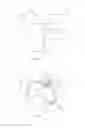 Fig. 04 - Well string stripper and stabilizer